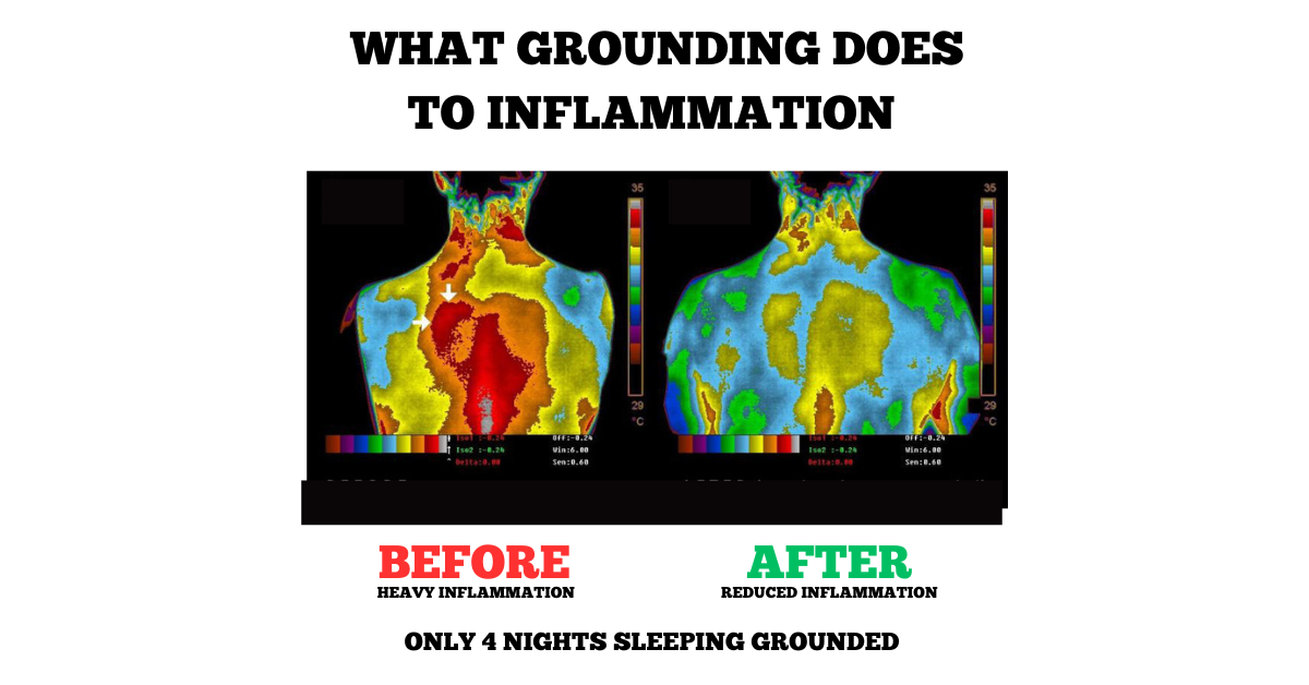 Skanto | Grounding Sleep Mat - Grounding Undersheet Pad for Improved Sleep Quality Grounding Wellness Therapy