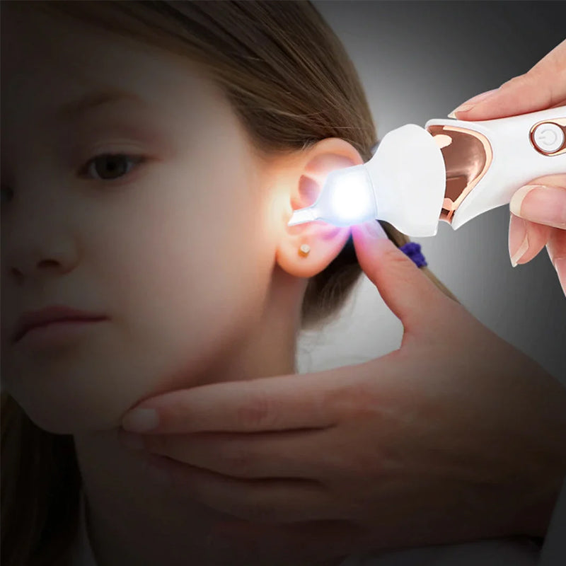 Skanto | 5-in-1 Electric Earwax Remover
