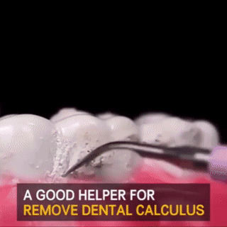 Skanto | Electric Tartar Remover