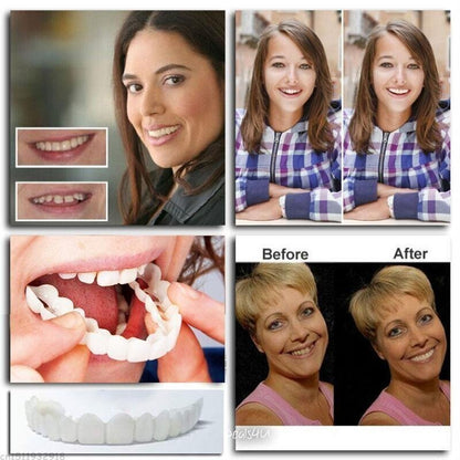 Adjustable, clip-on denture