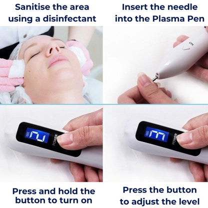 ClearSkinPro Laser Plasma Pen - Non-Invasive | for removal of freckles, skin tags, spots, moles, and tattoos at home Skanto
