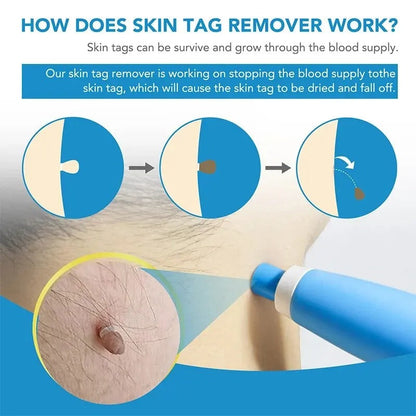 Skanto | Hair Removal Kit
