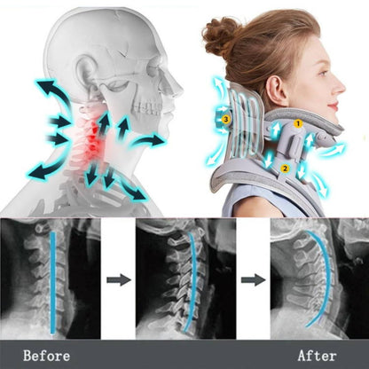 Skanto | Neck Stretcher for Pain Relief - Adjustable Cervical Traction Device Ideal for Neck Strain and Discomfort