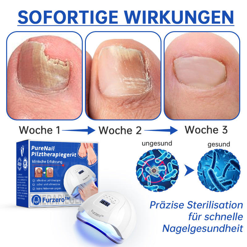 Skanto | PureNail™ | Nail Fungus Laser Treatment Device - Your Secret Weapon Against Nail Fungus