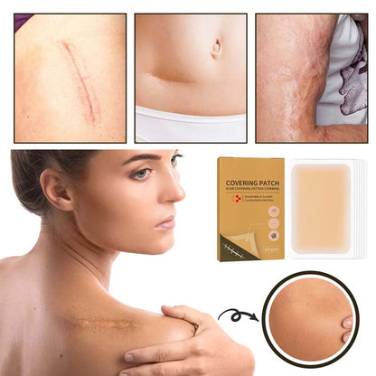 Skin-invisible covering patch