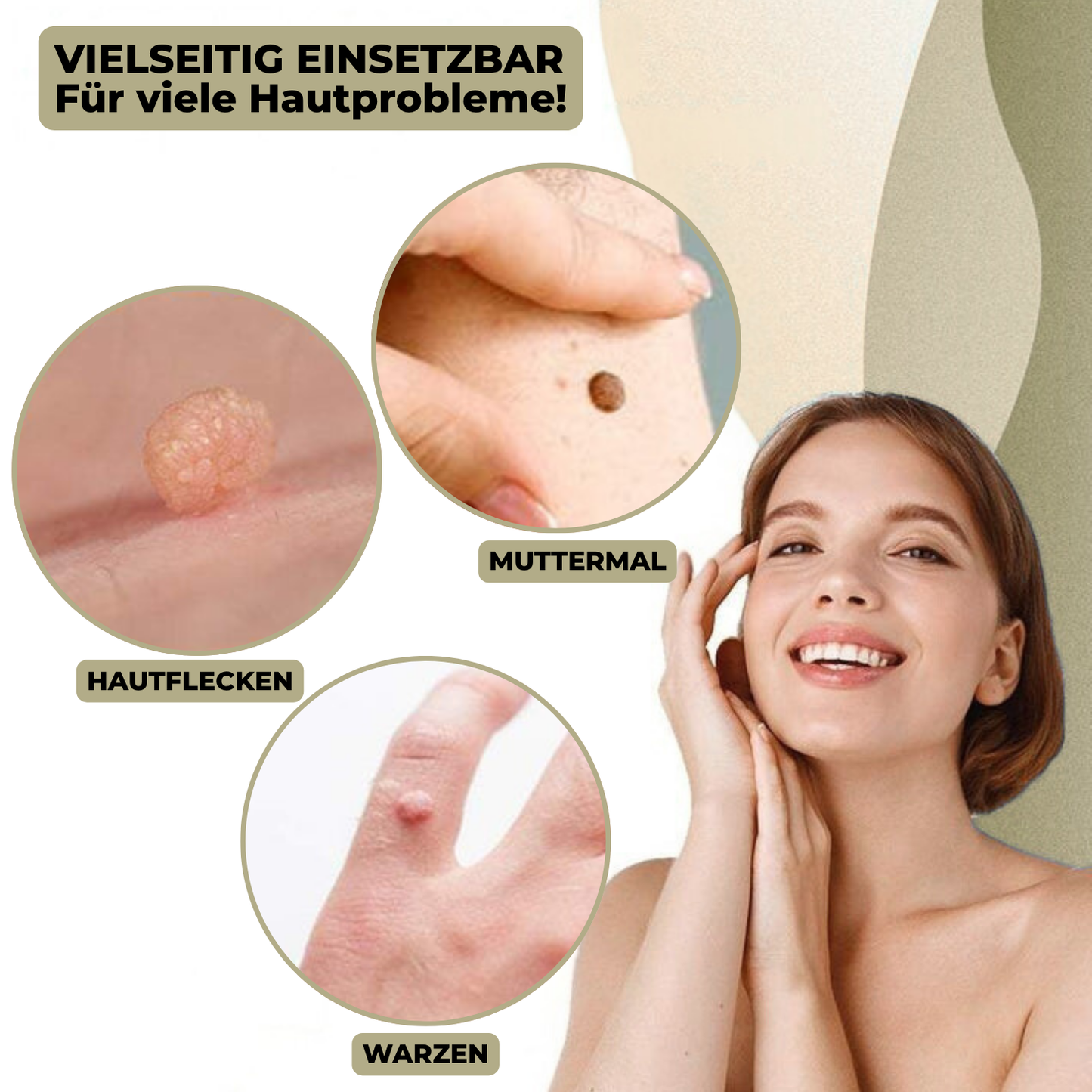 Skanto | DermaLinx Wart Remover | Pain-Free Removal of Warts and Moles | For Home Use | No Surgery