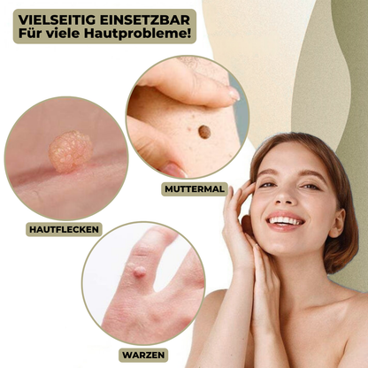 Kalsten | DermaLinx Wart Remover | Pain-Free Removal of Warts & Moles | For Home | Without Surgery