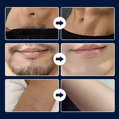 Skanto | Portable Shaver