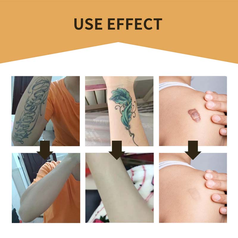 Skanto | Skin Invisible Concealer Patch