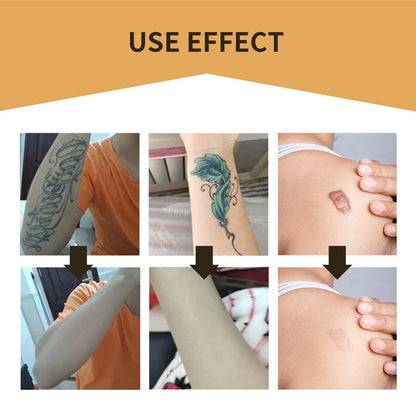 Skanto | Skin Invisible Concealer Patch