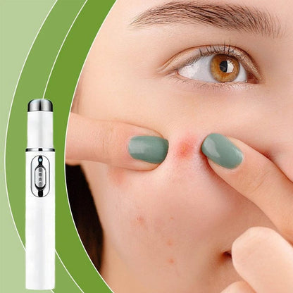 BowLift | ClearDerm - Quick, painless pimple removal for smooth, clear skin