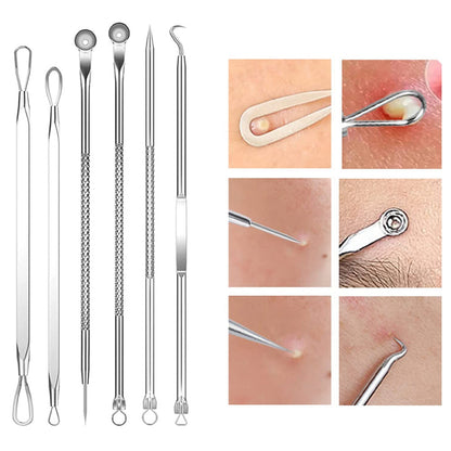 Skanto | Stainless Steel Blackhead Remover Pimple Popper Tool Kit with Metal Case