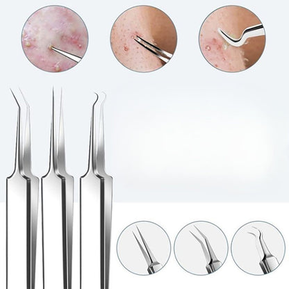 Skanto | Stainless Steel Blackhead Remover Pimple Popper Tool Kit with Metal Case