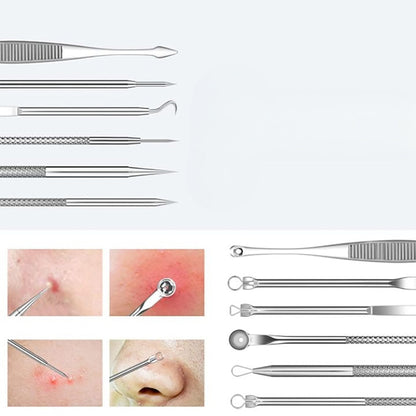 Skanto | Stainless Steel Blackhead Remover Pimple Popper Tool Kit with Metal Case