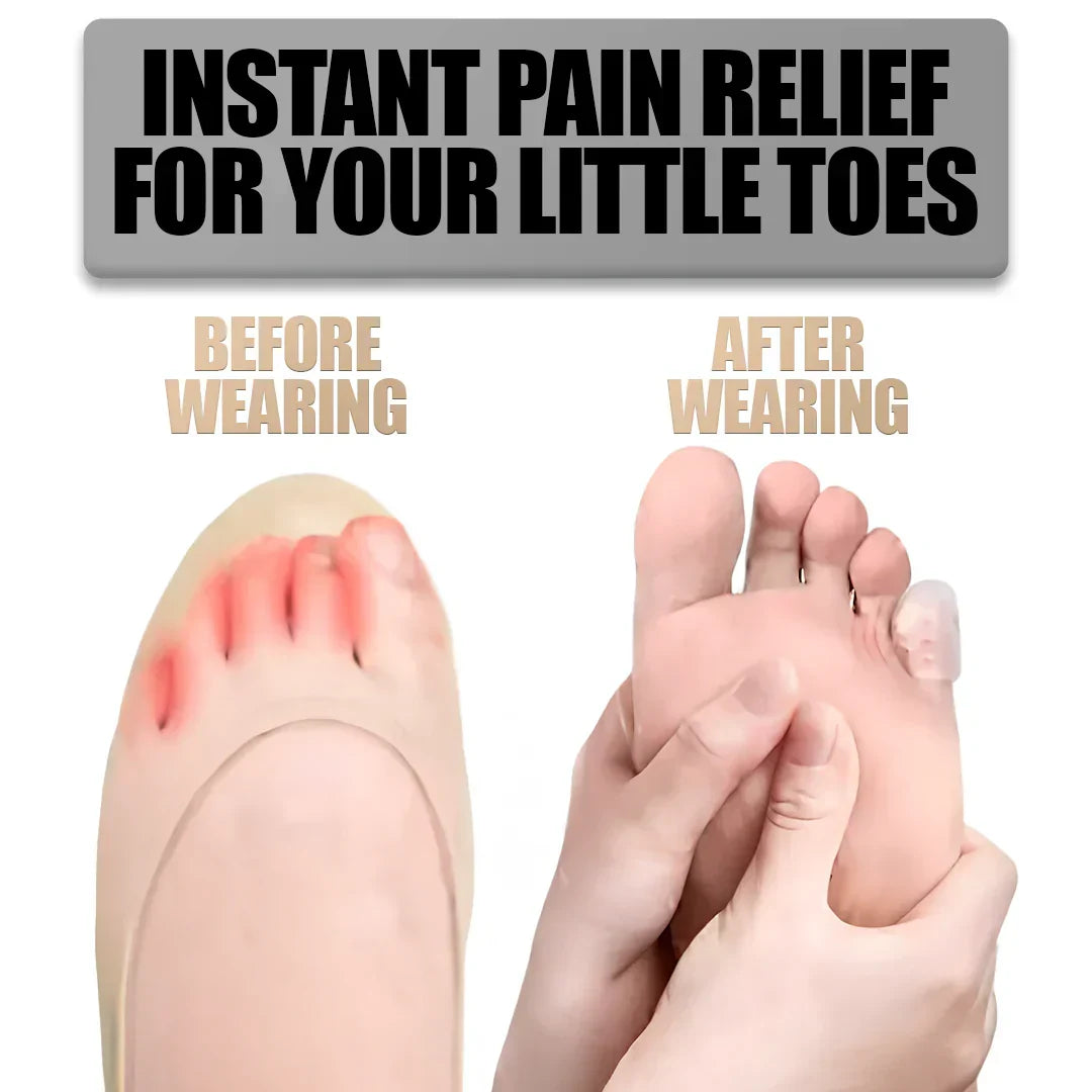 BowLift | Silicone Anti-Friction Toe Protectors