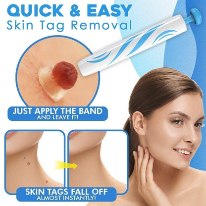 Skanto | SmoothZap — Faster pain-free skin freedom for a new sense of confidence in just 10 days