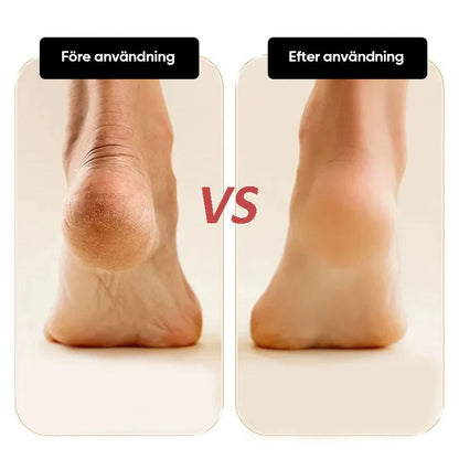 Skanto | Electric Foot File