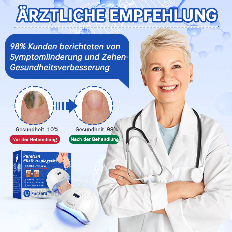 Skanto | PureNail™ | Nail Fungus Laser Treatment Device - Your Secret Weapon Against Nail Fungus