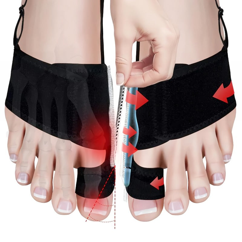 Skanto | Adjustable Hallux Valgus Corrector