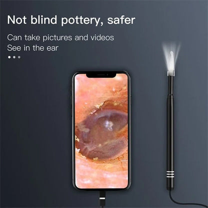 Skanto | Ear Cleaner with Camera