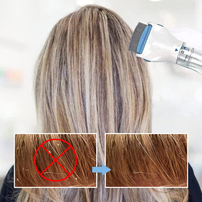 Skanto | V-Comb Head Lice Machine With 3 Filters