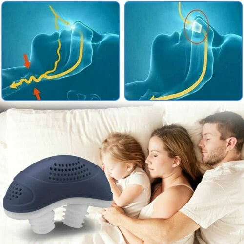 Skanto | Sleepless, Mask-Free, Micro-CPAP Anti-Snoring