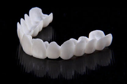 Smile Lens – Adjustable White Denture for Instant Smile Correction | Kalsten