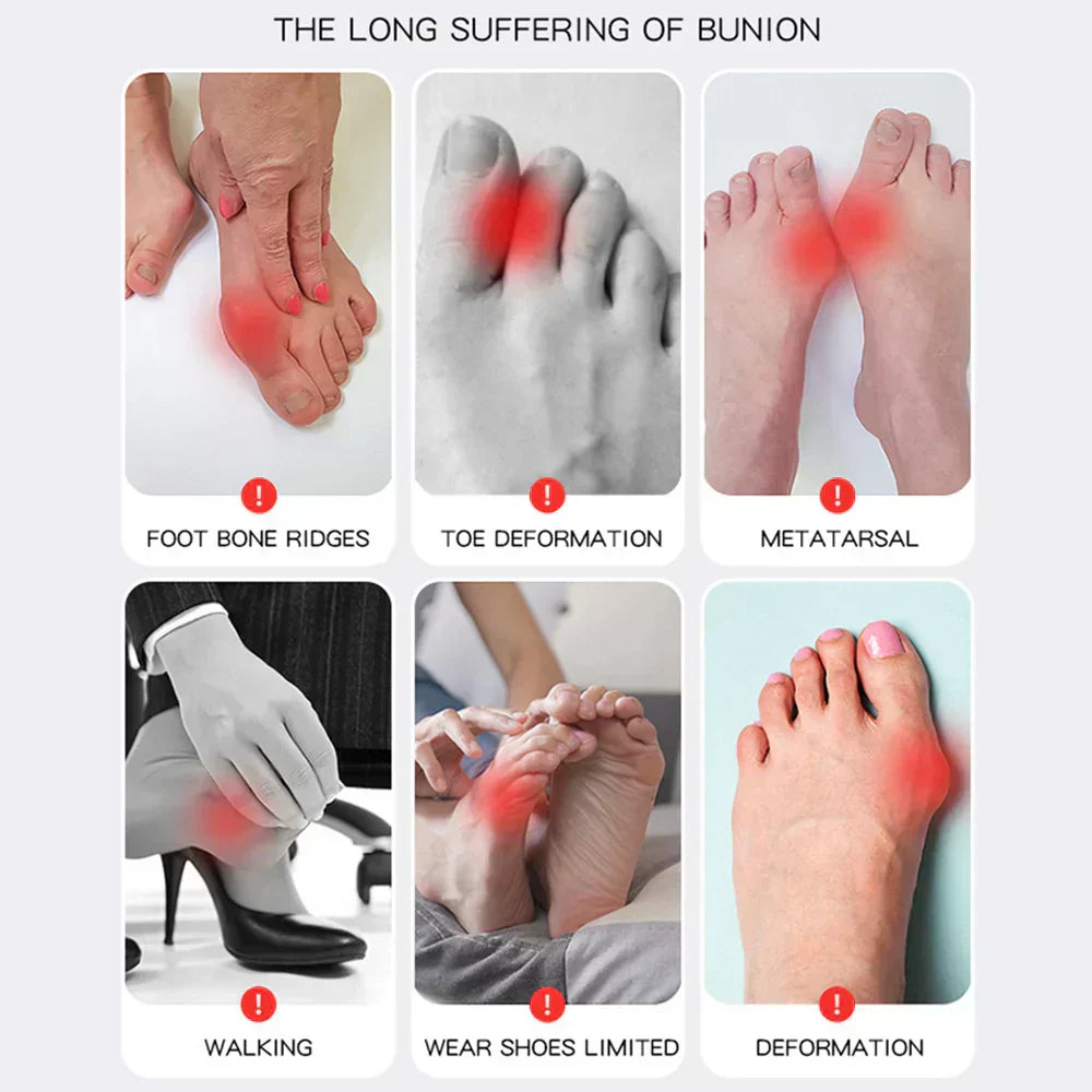 BowLift | OrthoFlex – Comfortable walking with Hallux Valgus relief!