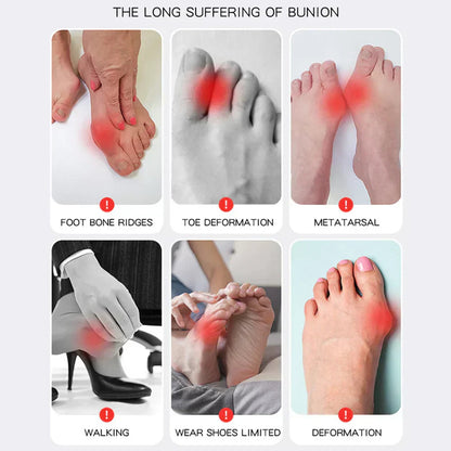 BowLift | OrthoFlex – Comfortable walking with Hallux Valgus relief!