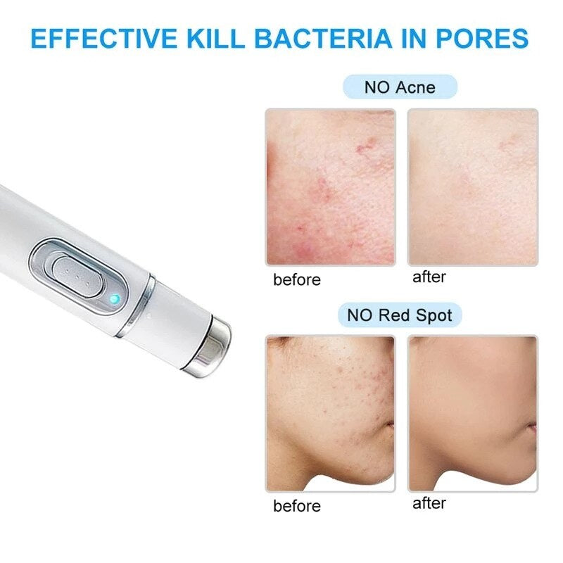 BowLift | Laser Ultrasonic Skin Tightening Machine