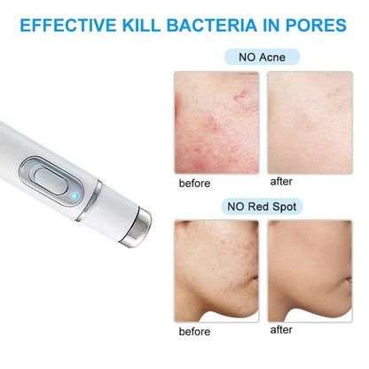 BowLift | Laser Ultrasonic Skin Tightening Machine