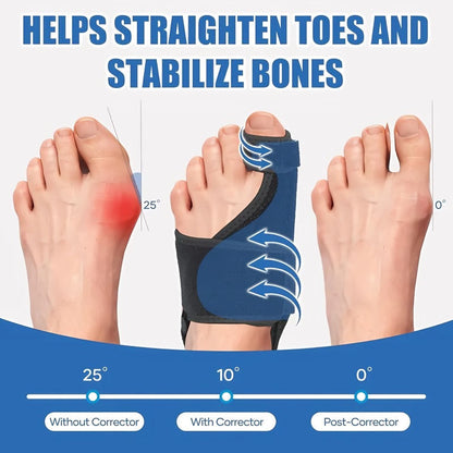 Skanto | Adjustable Hallux Valgus Corrector
