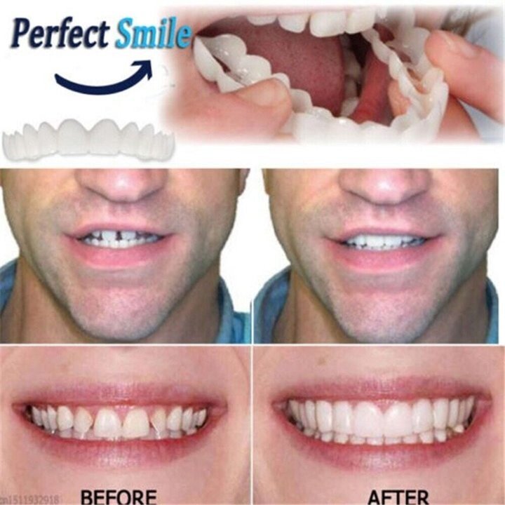 Skanto | Adjustable Snap-On Dentures