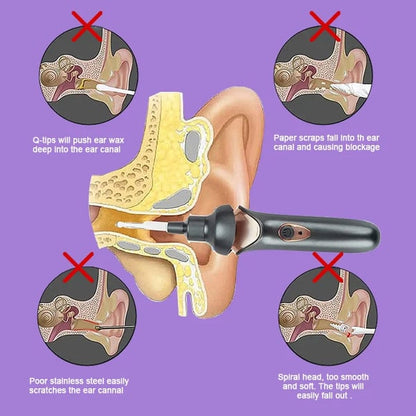 BowLift | Painless Ear Wax Removal Kit – Safe & Effective Cleaning for the Whole Family