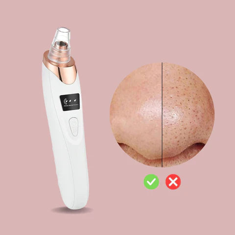 Skanto | Nano Electric Vacuum Blackhead Remover — Unleash Your Radiant, Clear Skin Without Pain or Stress