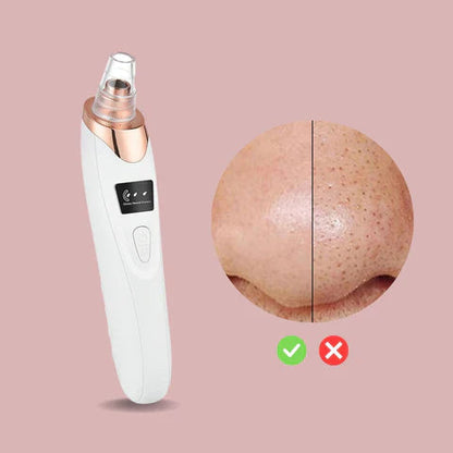 Skanto | Nano Electric Vacuum Blackhead Remover — Unleash Your Radiant, Clear Skin Without Pain or Stress
