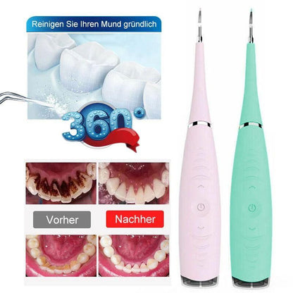 Ultrasonic tooth cleaner