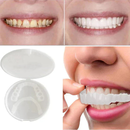 SnapFit Tooth Restoration | Always a flawless smile