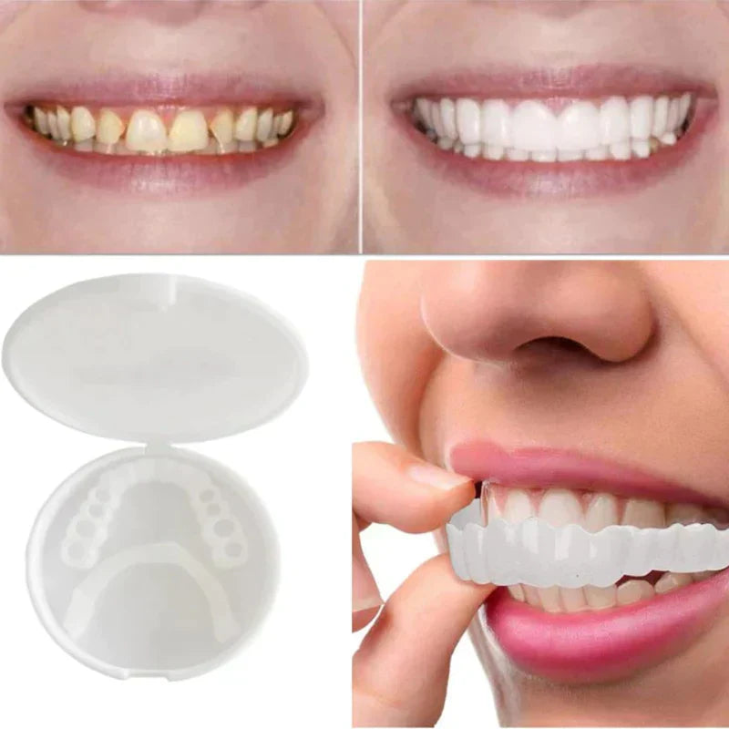 BowLift | SnapFit Dental Restoration | Always a Flawless Smile