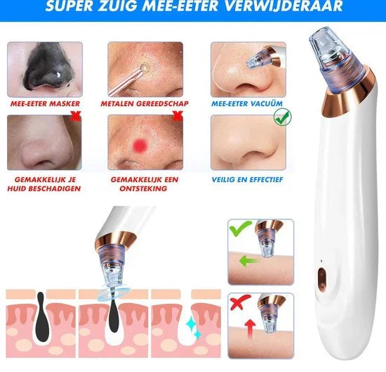 BowLift | Electric Blackhead Remover
