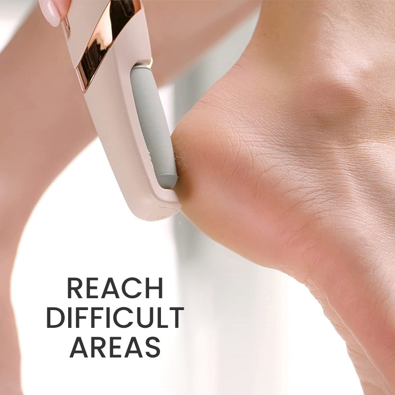 Skanto | Rechargeable Pedicure Tool USB Wireless Electric Foot File