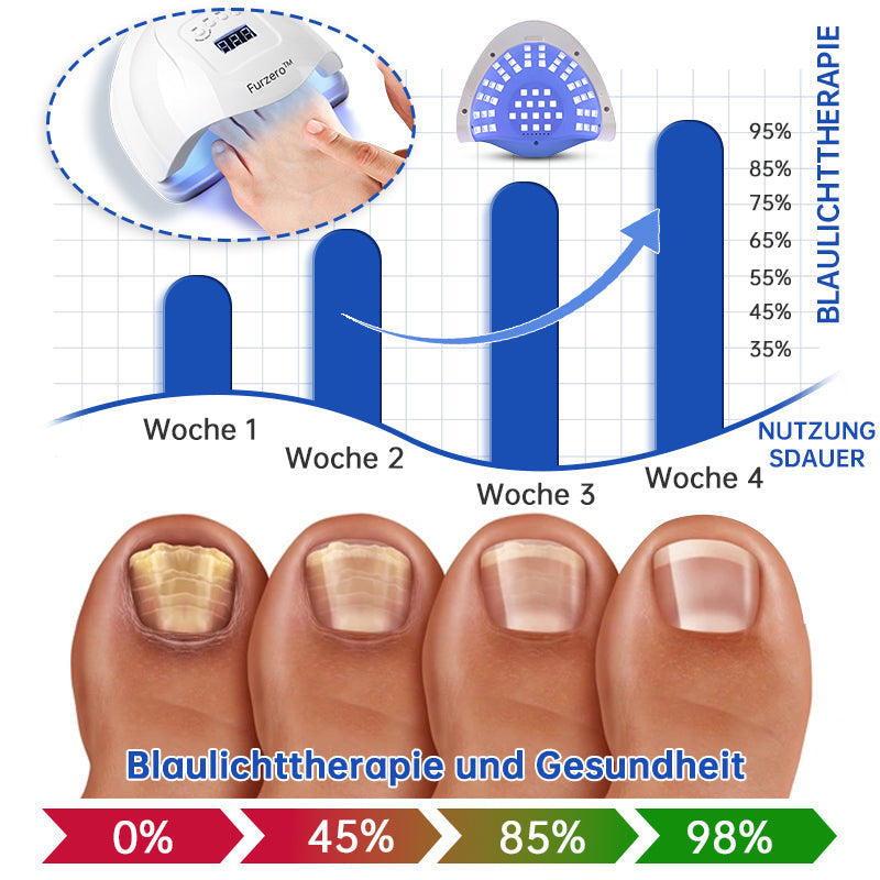 Skanto | PureNail™ | Nail Fungus Laser Treatment Device - Your Secret Weapon Against Nail Fungus