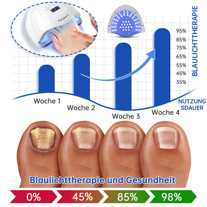 Skanto | PureNail™ | Nail Fungus Laser Treatment Device - Your Secret Weapon Against Nail Fungus