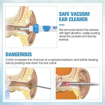 Skanto | Earwax Remover Vacuum