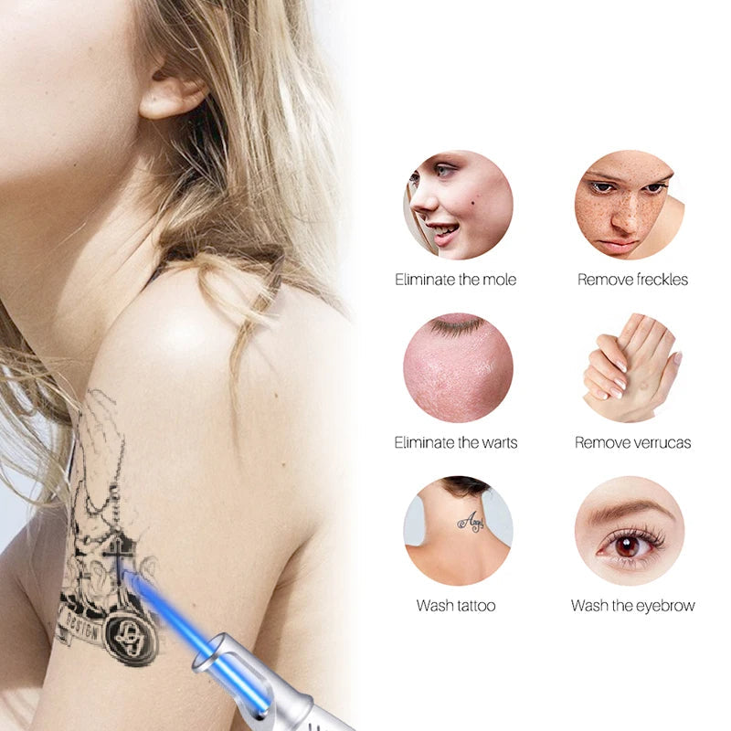 Skanto | Smart Tattoo Removal Laser Pen - Remove Moles, Freckles, Acne, Tattoos