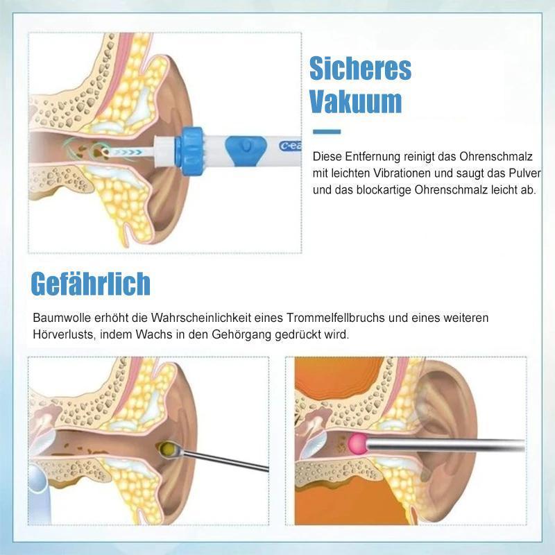 Skanto | Vacuum Earwax Remover