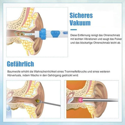 Skanto | Vacuum Earwax Remover