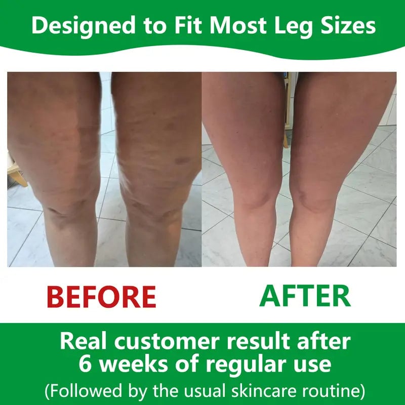 BowLift | Sakerplus Cellulite Massage Roller