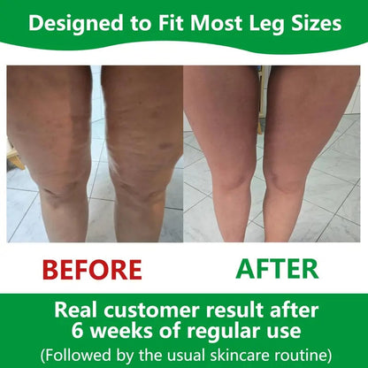 Kalsten | Sakerplus Cellulite Massage Roller