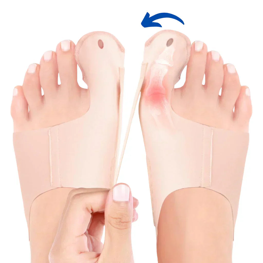 BowLift | OrthoFlex – Comfortable walking with Hallux Valgus relief!